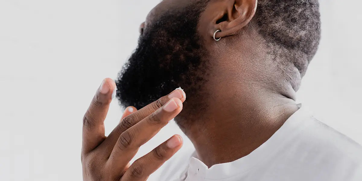 Man applying minoxidil for beard growth.