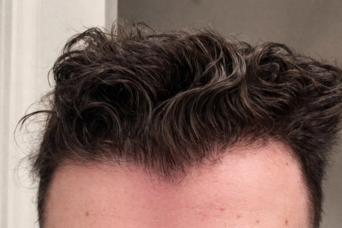 Before — C.D.