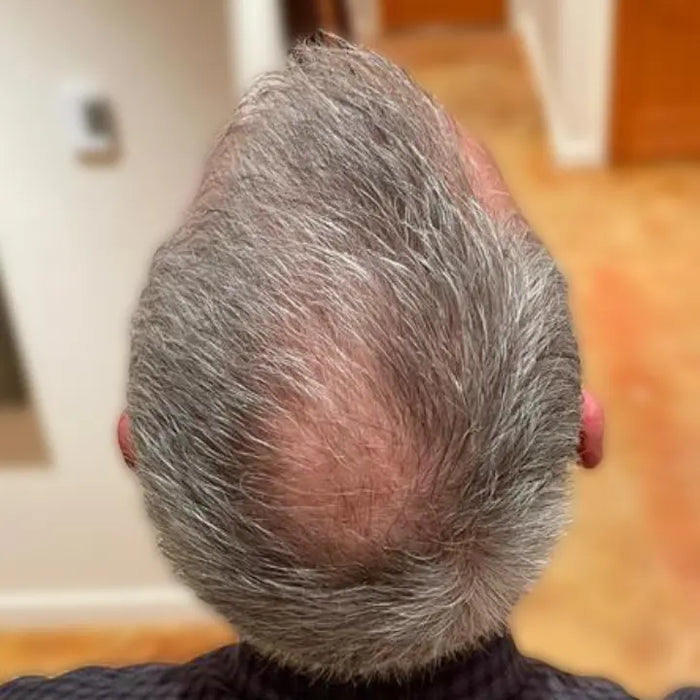 Before — D.X.
