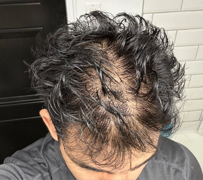 Before — Nirav P.