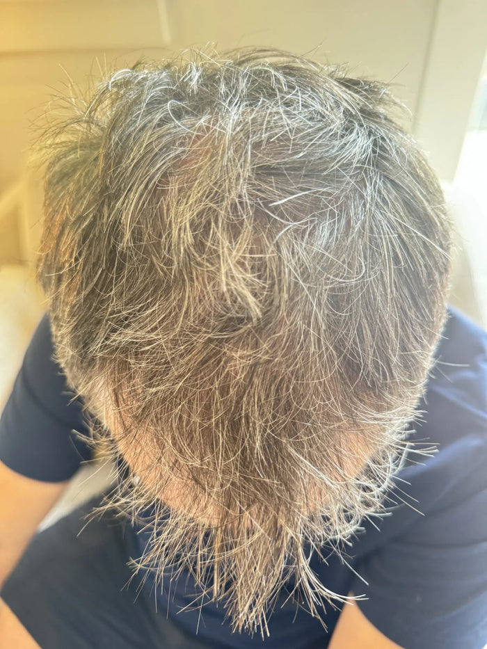After — P.C.