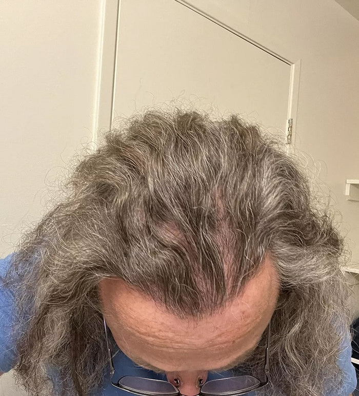 Before — T.E.