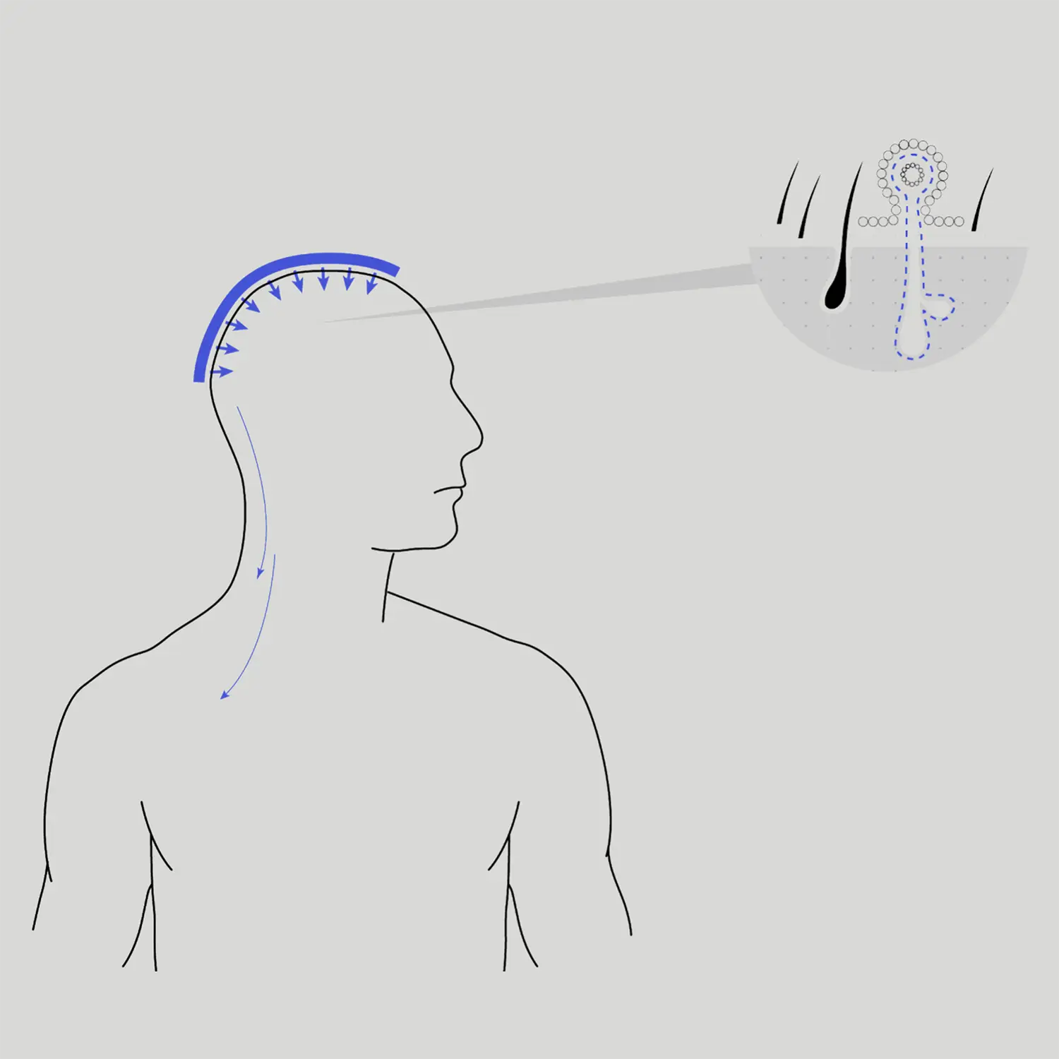 image of finasteride on hairline illustration