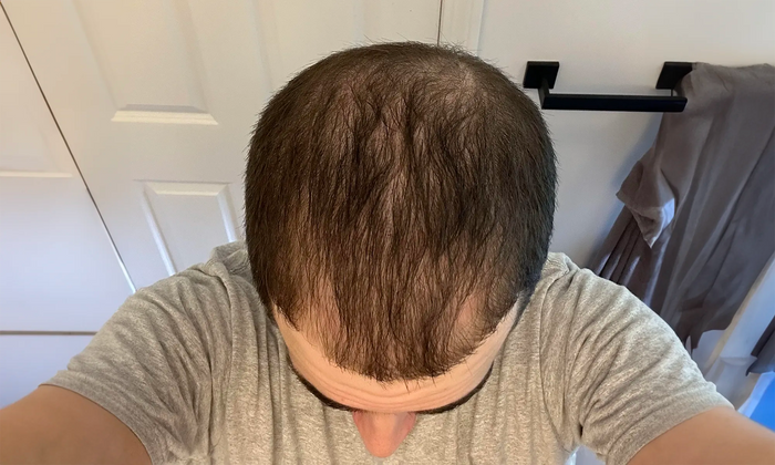 After — Chris M.