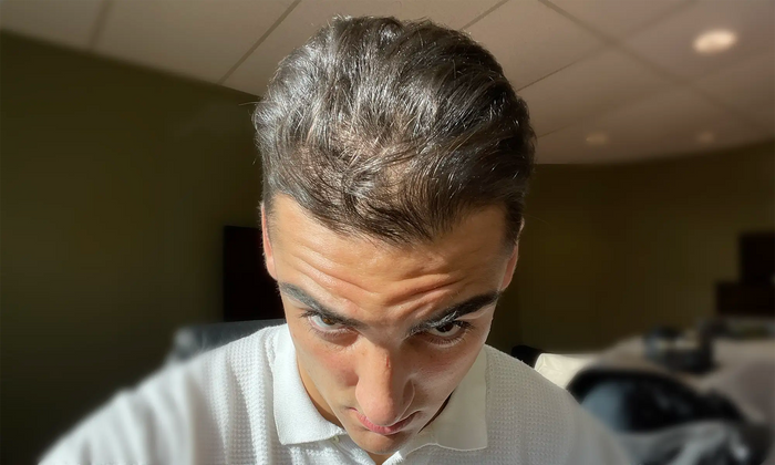 Before — J.D.