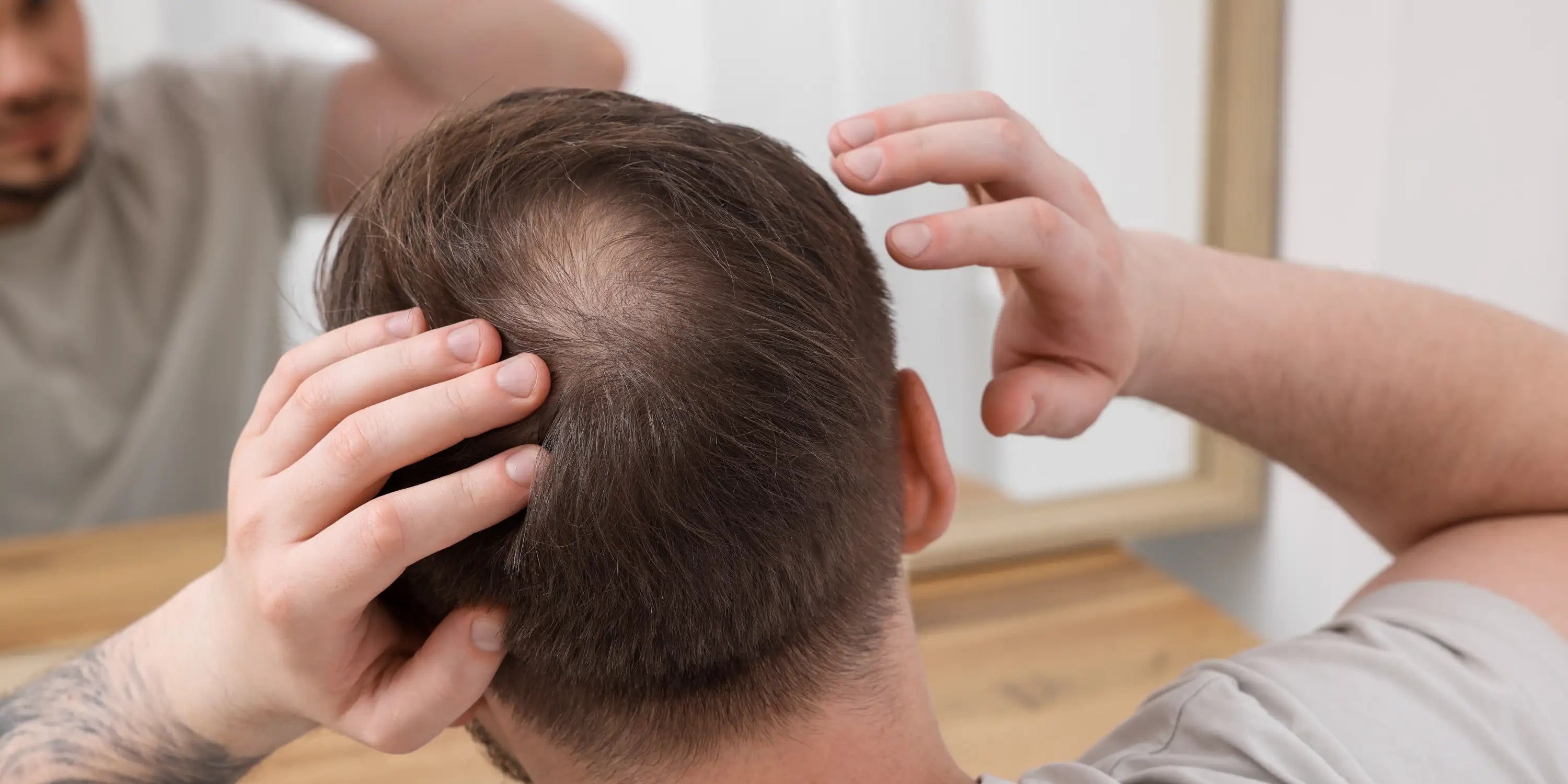 man inspecting bald spot in mirror