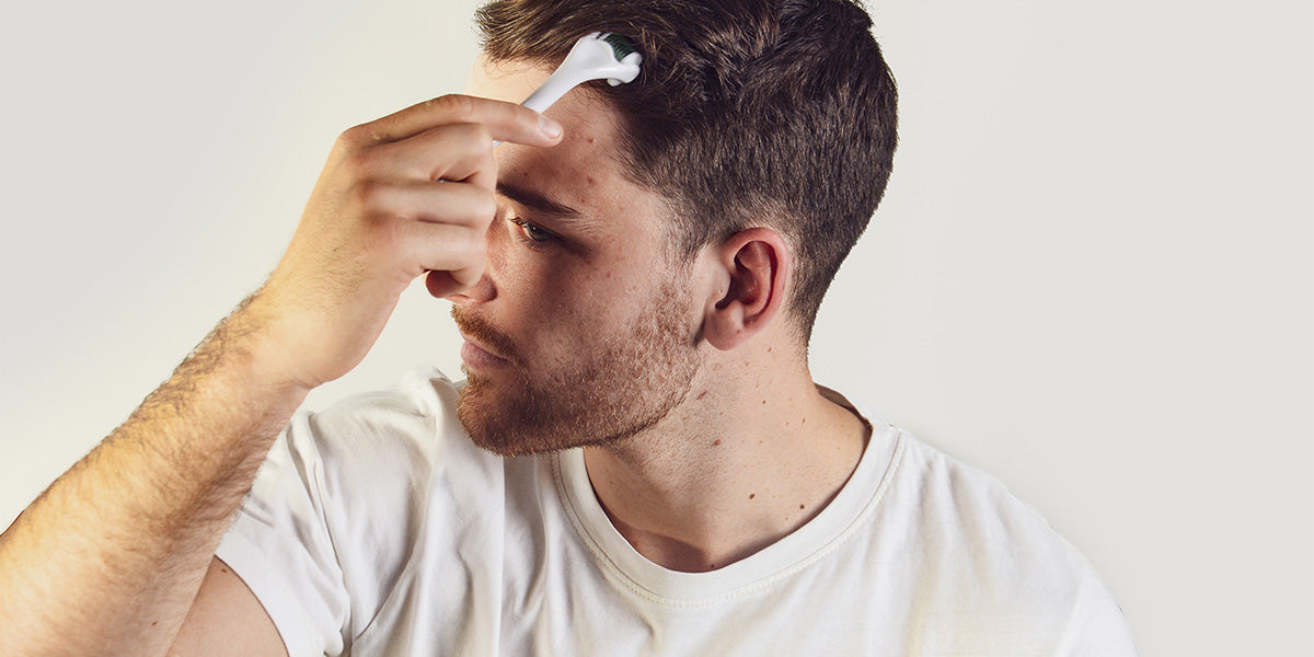 Young man microneedling his hairline.