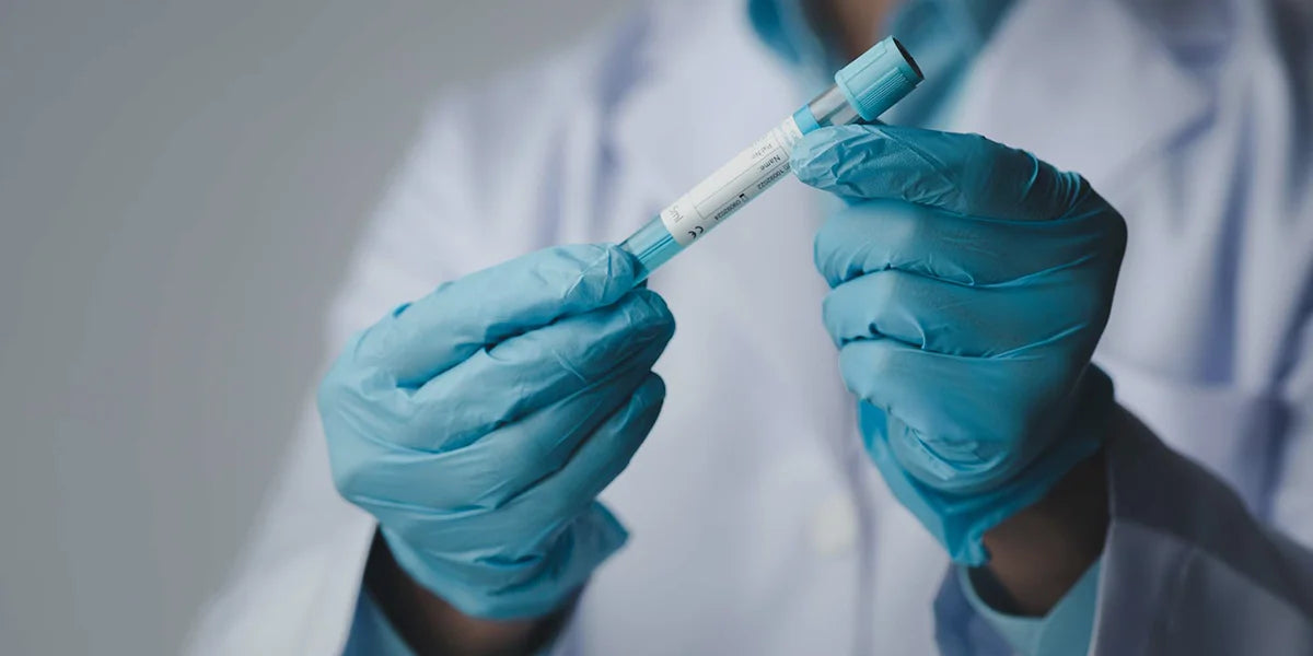 Topical dutasteride clinical trial scientist holding blood test tube.