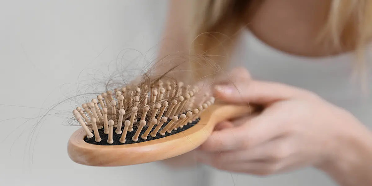 Woman with female pattern hair loss holding brush full of hair.