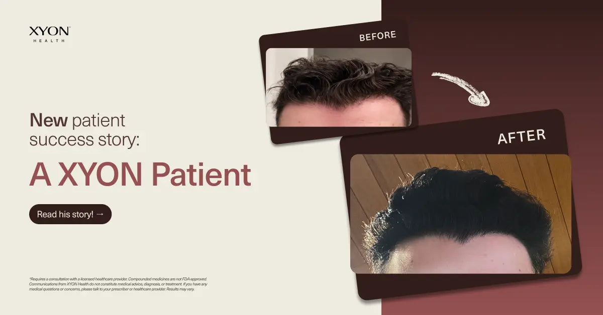 XYON Patient Success Story: C. D.