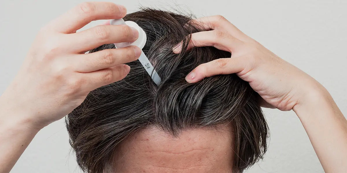 How to Use Minoxidil | Application Tips, Dosing and Precautions