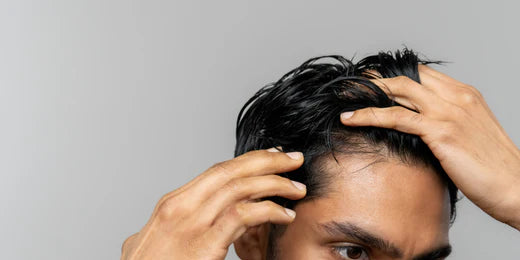 Image of man pulling his hair back to reveal his hairline.