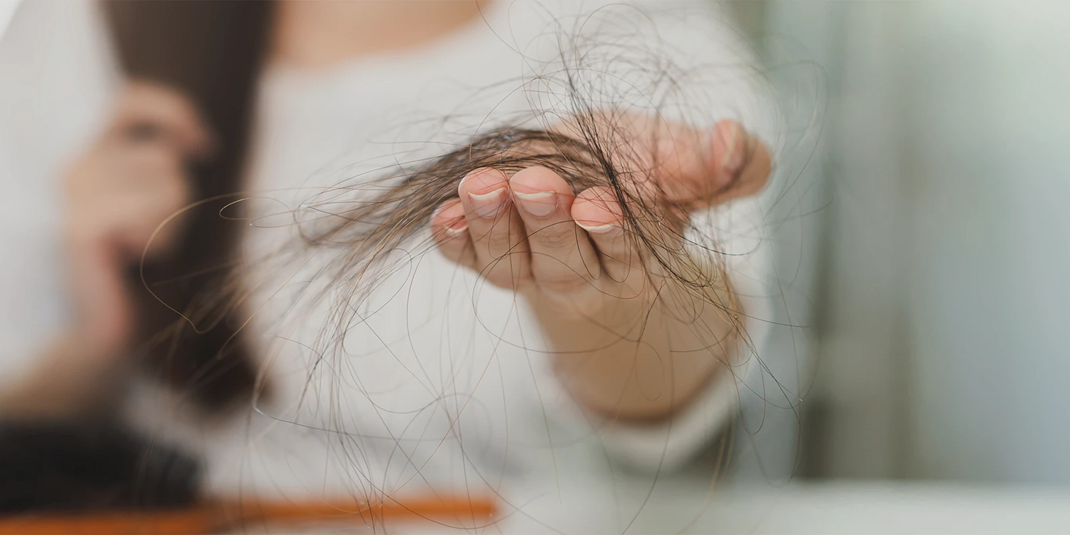 Young woman holding handful of minoxidil shedding hair.
