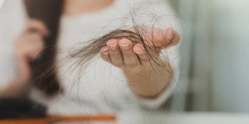 Minoxidil shedding