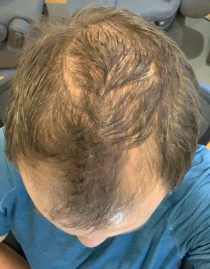 Before — A.B.