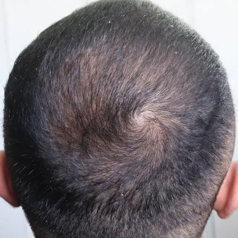 A.H. — after treatment