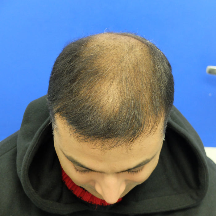 Before — A.J.