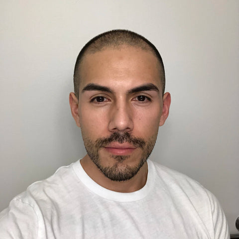 F.P. — before treatment