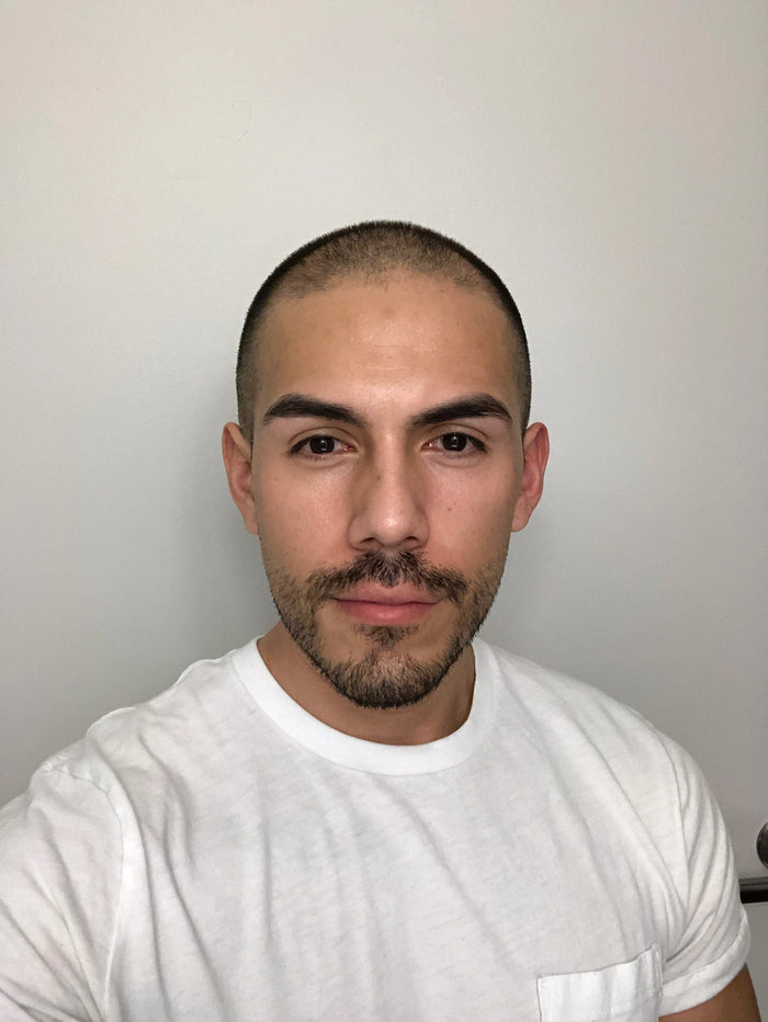 Before — F.P.