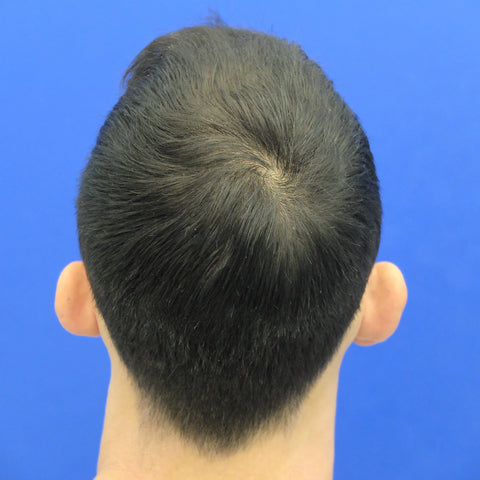 G.Y. — after treatment