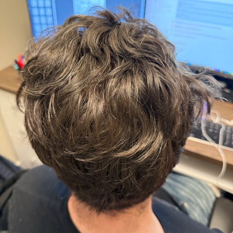 J.B. — after treatment