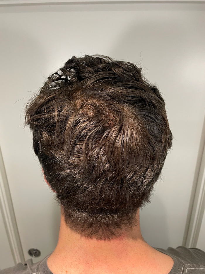 Before — J.B.