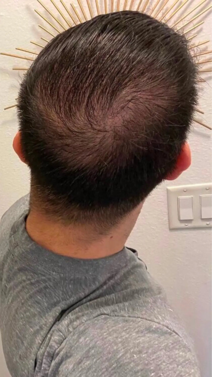 Before — M.L.