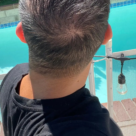 M.L. — after treatment