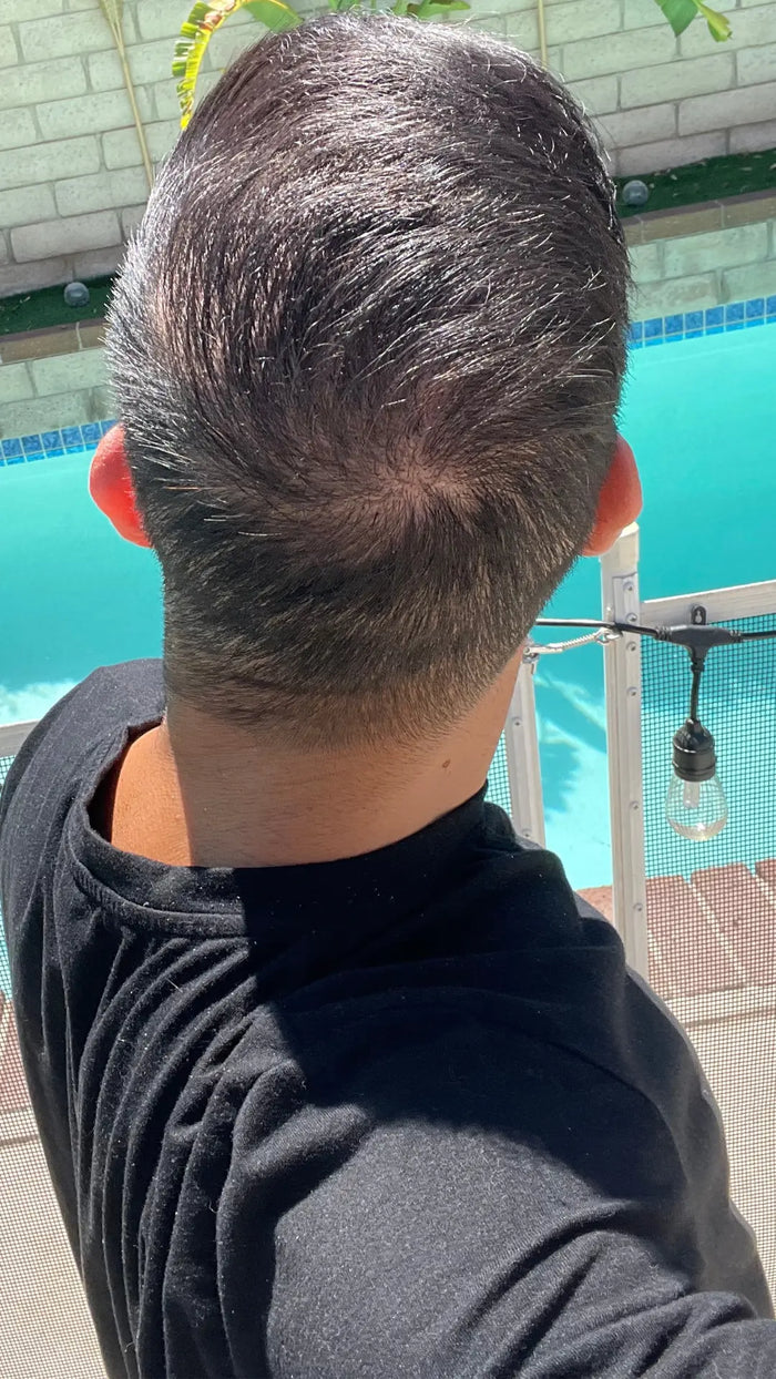 After — M.L.