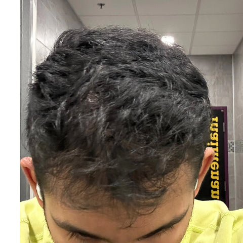 Nirav P. — after treatment