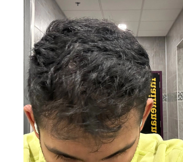After — Nirav P.