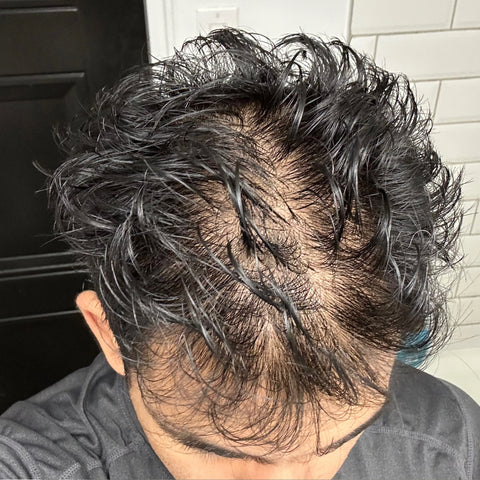 Nirav P. — before treatment