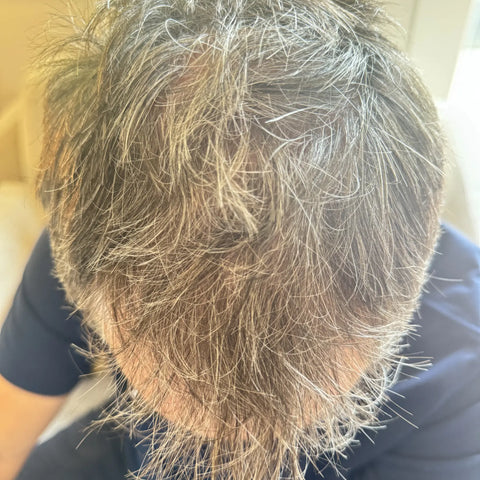 P.C. — after treatment