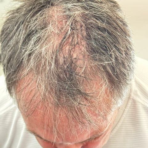 P.C. — before treatment