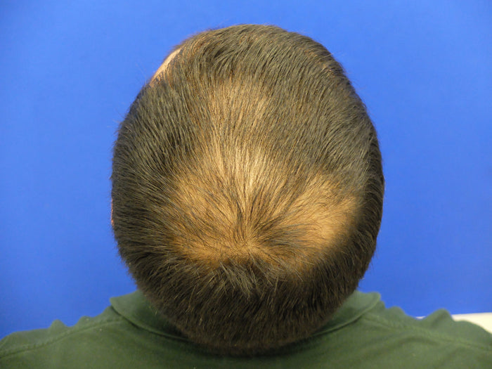 Before — S.B.