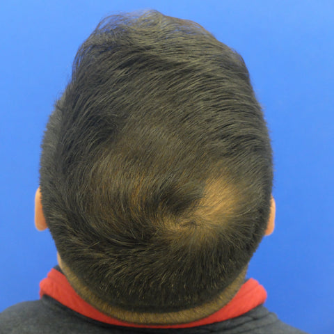 S.B. — after treatment