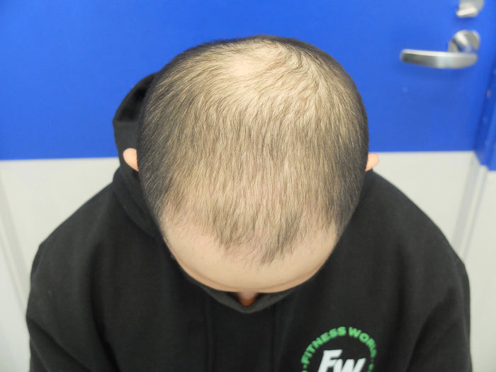 Before — V.Y.X.