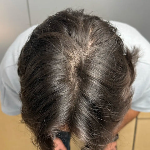 JV — after treatment