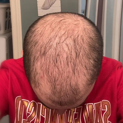 Chris M. — before treatment
