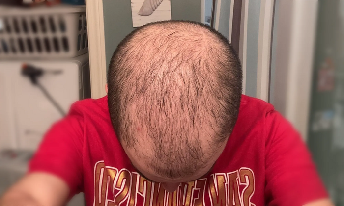 Before — Chris M.