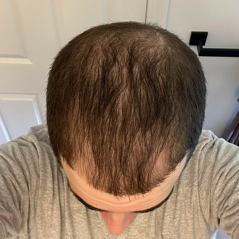 Chris M. — after treatment